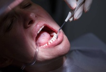 牙龈炎可以彻底的治愈吗 联合多个方法根除牙龈炎