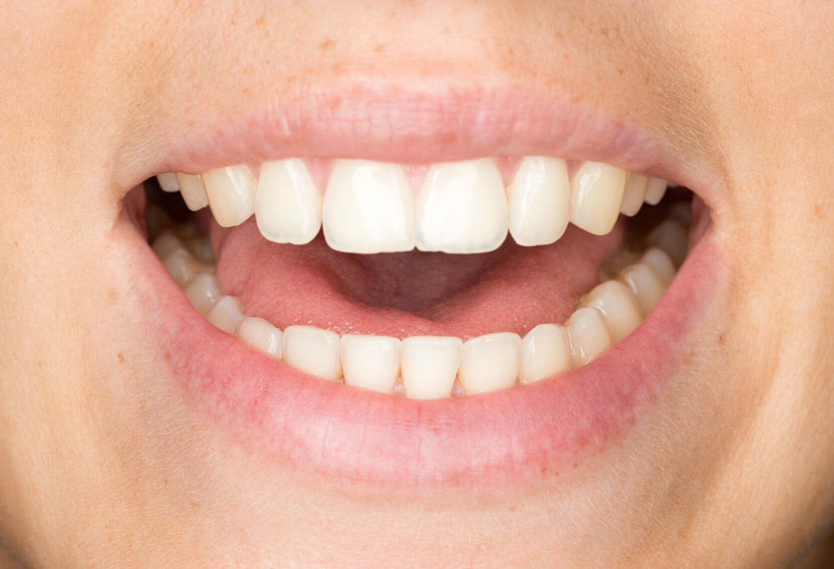 牙周炎牙齿松动需要拔牙吗？