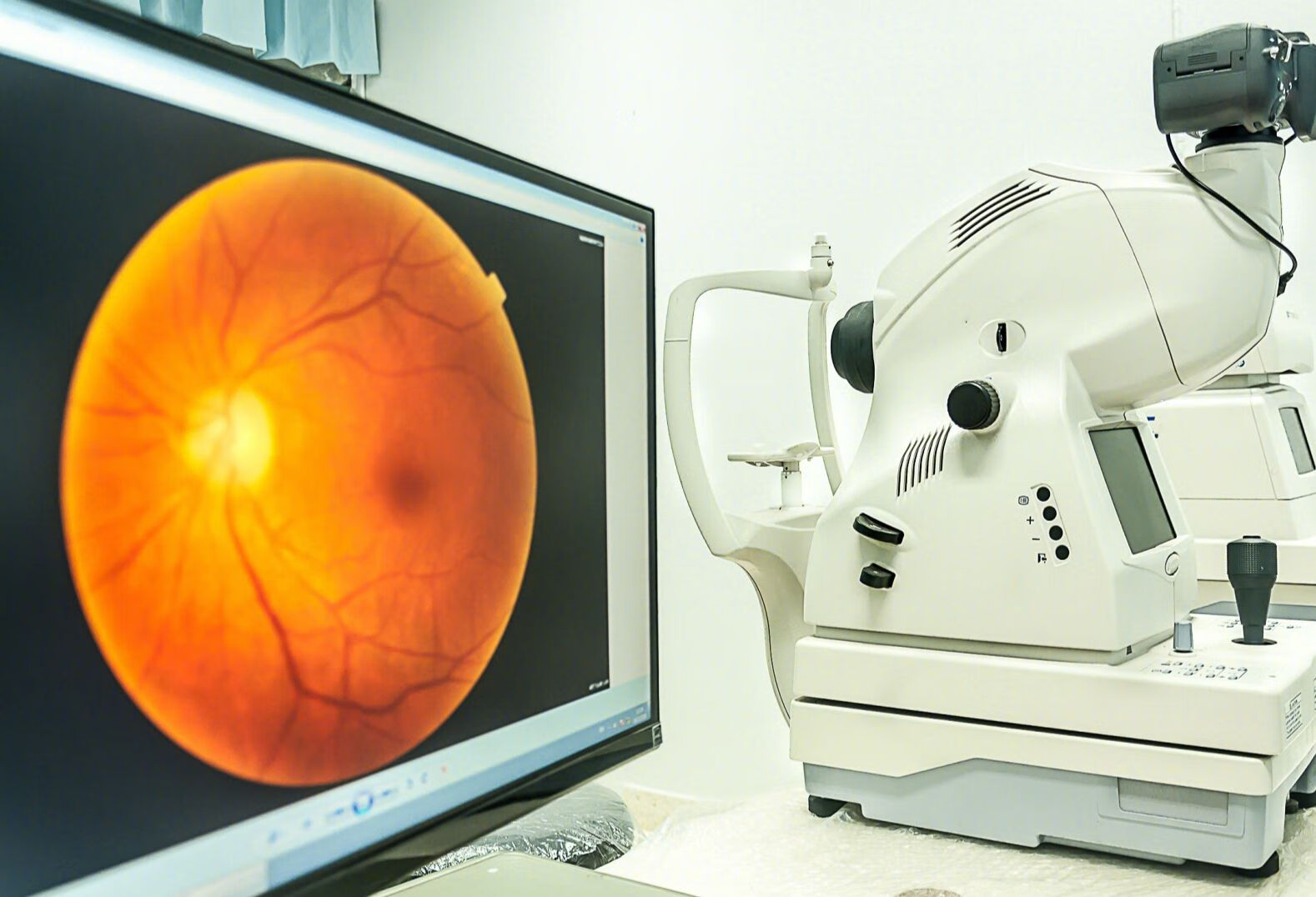 视网膜脱离患者日常有什么需要注意的？