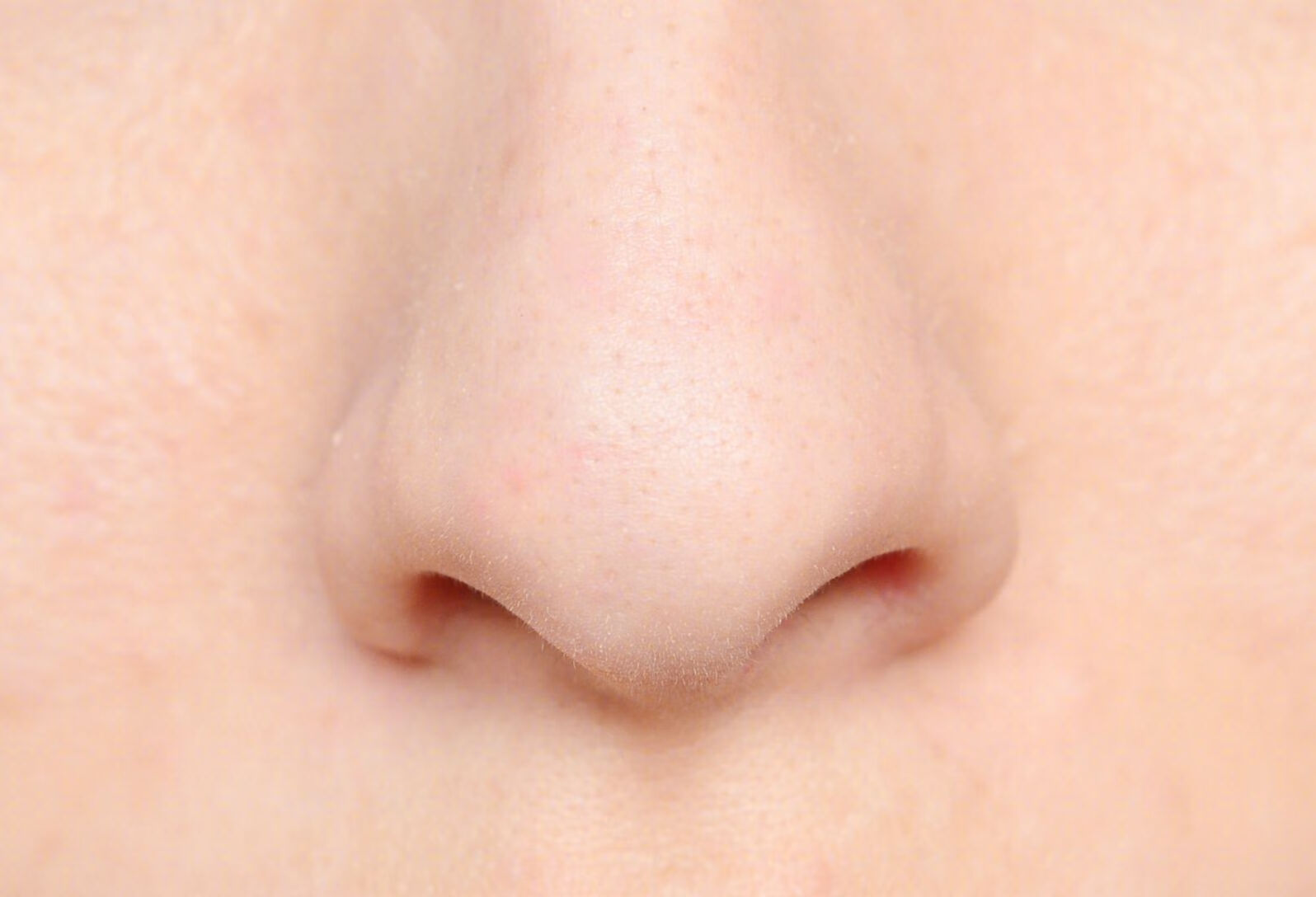 经常被眼袋泪沟以及鼻基底凹陷的问题困扰，该怎么改善？