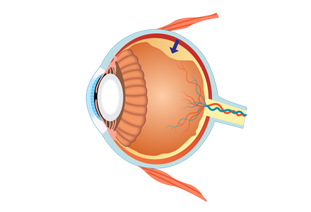 菊花可致结膜炎 6种中药盲目使用会伤眼 