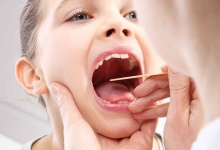 舌头被烫伤多久可以好 4招护理加快舌头康复