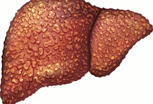 影响肝功能检查结果的4个因素 怎么确保肝功能检查结果的准确性？