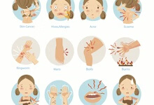 皮肤瘙痒症图片介绍 认识瘙痒症4大症状