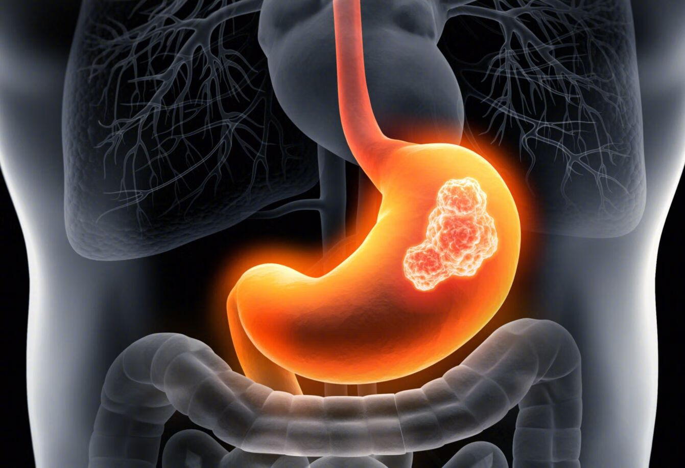 胃危象具有哪些表现 