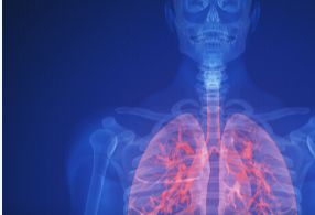 肺粘连怎么治疗好得快？
