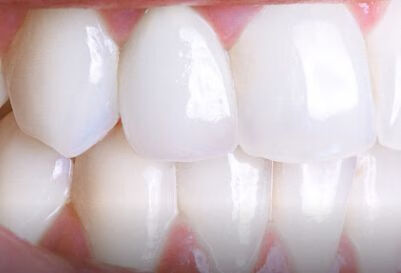 牙髓炎吃什么药治疗？