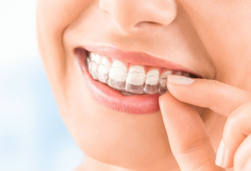 牙齿矫正拔牙有后遗症吗？