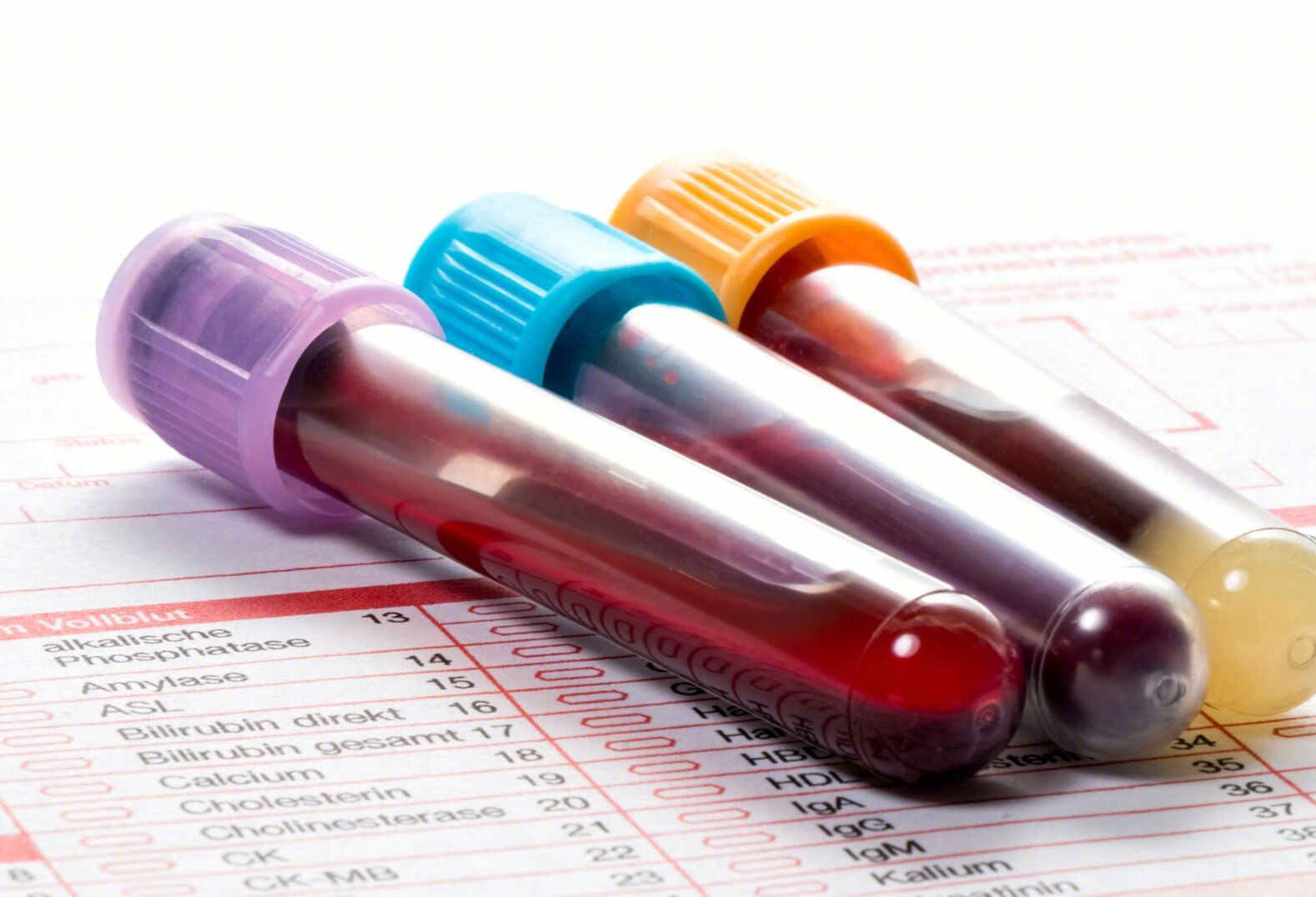 血生化和血常规的区别有哪些？
