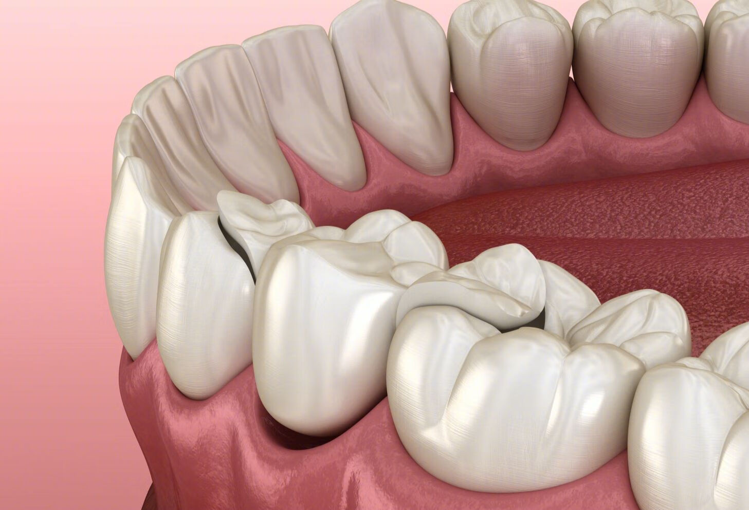 牙齿发麻是什么病的征兆呢？