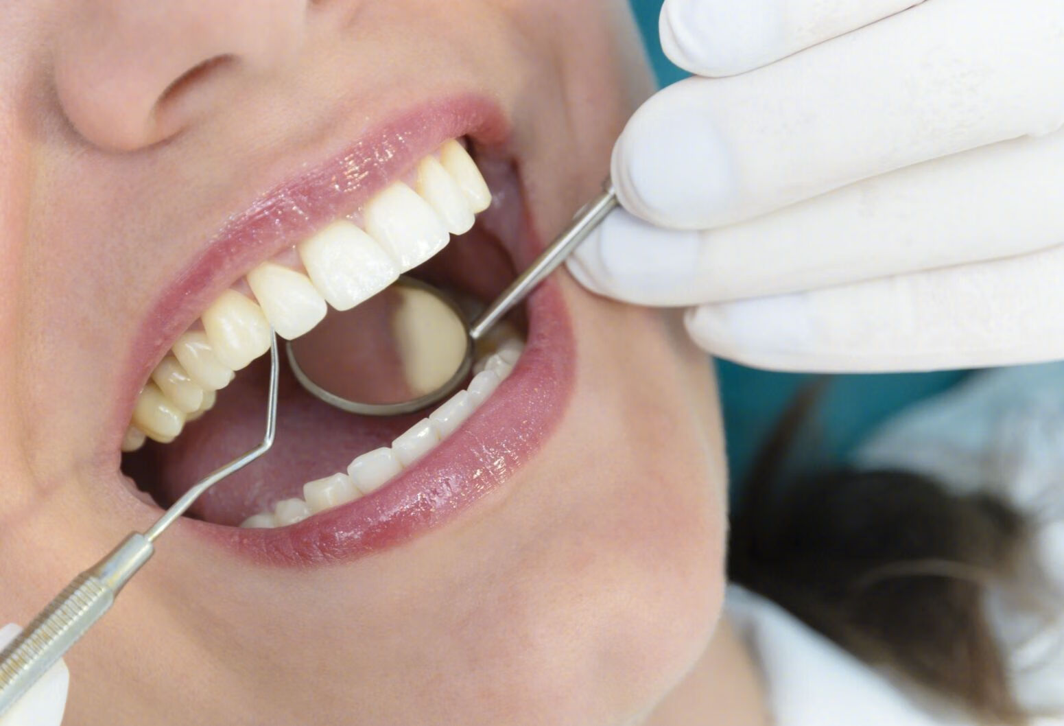 牙周炎和牙髓炎有什么区别？