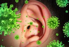 中耳炎的症状表现有哪些？