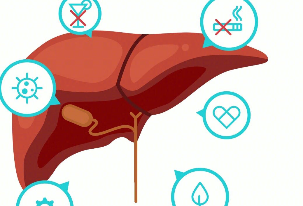 肝结节是肝癌早期症状吗?