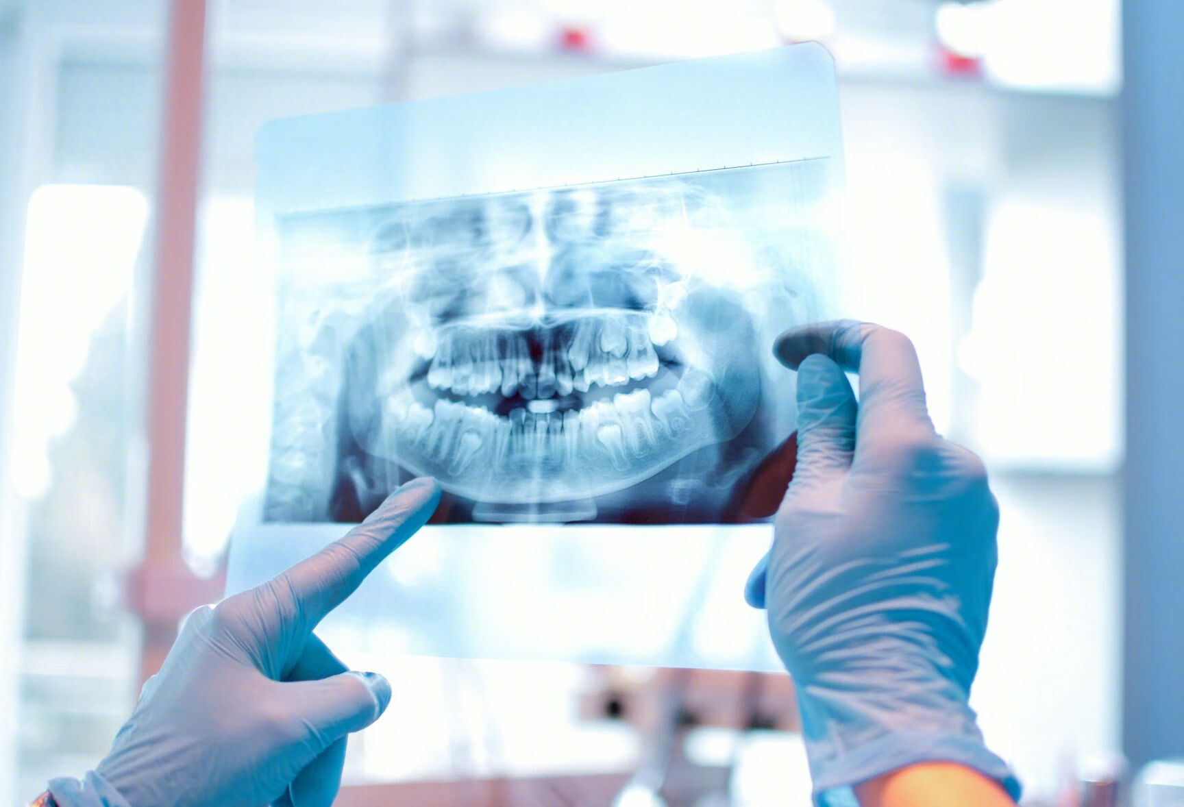 大牙后面的牙肉肿痛喉咙痛是怎么回事？