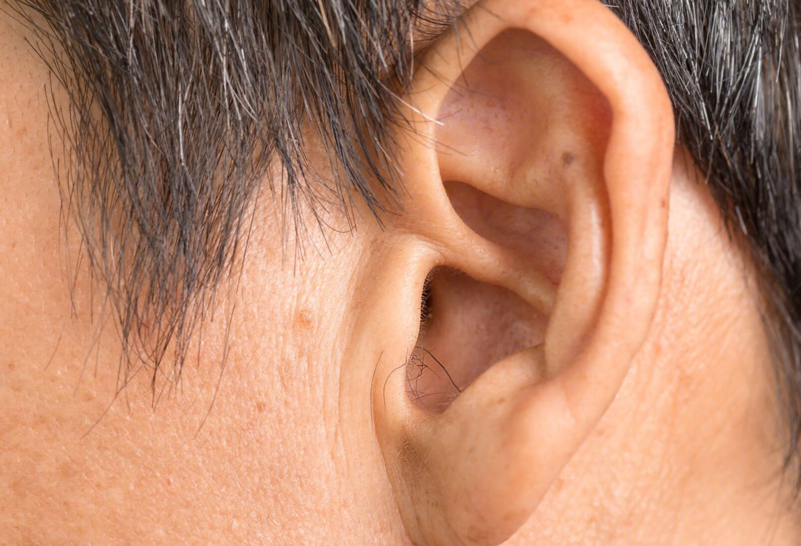 外耳道炎反复发作怎么办？