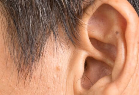 突发性聋是什么原因？
