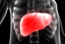 药物性肝损伤需要和哪些疾病鉴别诊断