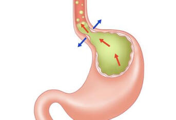 有食管裂孔疝史应警惕胃扭转