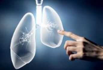 慢阻肺的综合管理，一定重视起来！