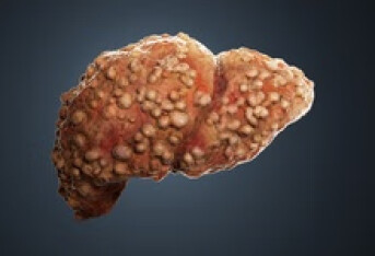 肝属于什么系统 肝脏不好的症状有哪些