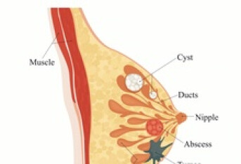 乳腺炎可以吃鸡蛋吗