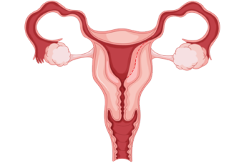 如何减少卵巢癌的复发 