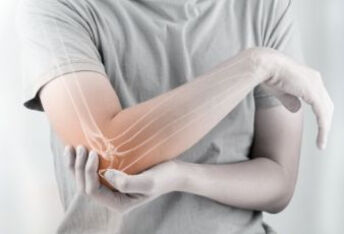 类风湿性关节炎导致的跛行和残疾