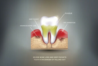 牙龈萎缩患者的日常有什么需要注意的？
