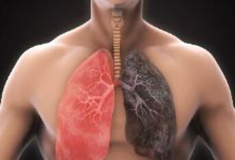 肺结核的诊断标准有哪些？