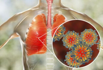 肺癌每年带走60万人！出现3种信号，多是肺癌敲门