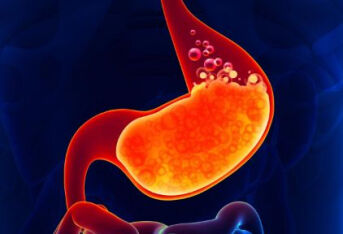 体检发现胃息肉怎么办，哪些人应该定期检查胃镜？