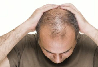 脱发的常见原因都有哪些？