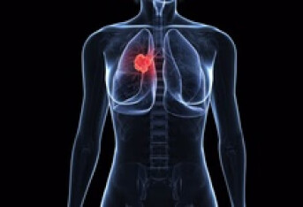 肺癌晚期的症状表现