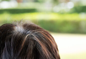 “白头发”可能预示这些疾病！5个因素导致长白发