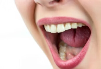 口角炎是由什么引起的 引起口角炎的6个原因很常见