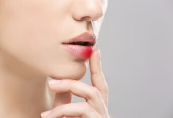 微小型唇裂的治疗方法有哪些