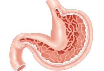 胃穿孔的原因是什么