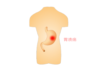 长期喝粥并不养胃！想正确养胃，做好这几件事