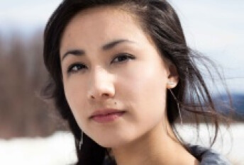 女生脸上的痣可以点吗