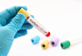 慢性荨麻疹吃药能好吗 治疗方法包括哪些？