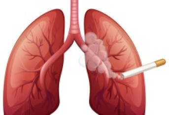 矽肺和肺癌的区别有哪些