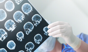 癫痫患者常伴有头痛，应该如何处理？