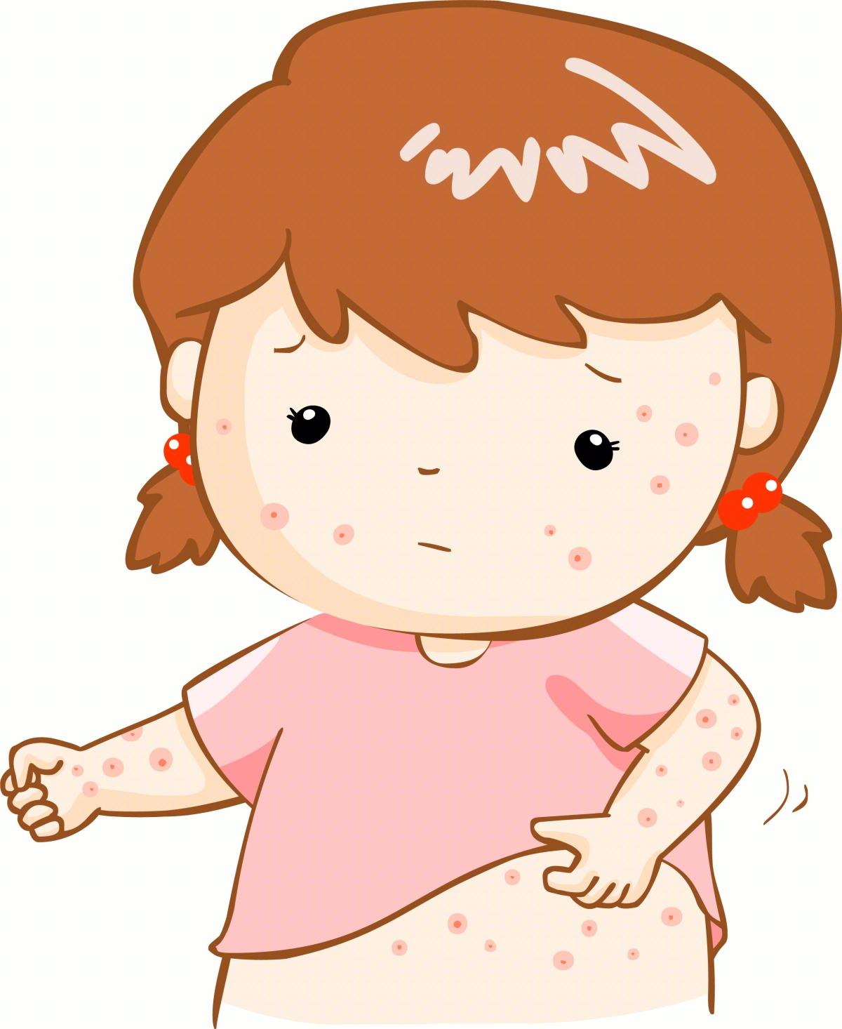 水痘的症状和治疗 一般几天能好 - 美容护肤 - 蓝灵育儿网