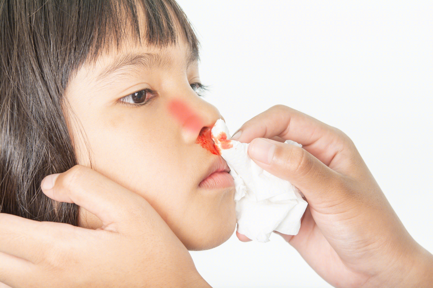正确处理流鼻血的三步 - 资讯频道