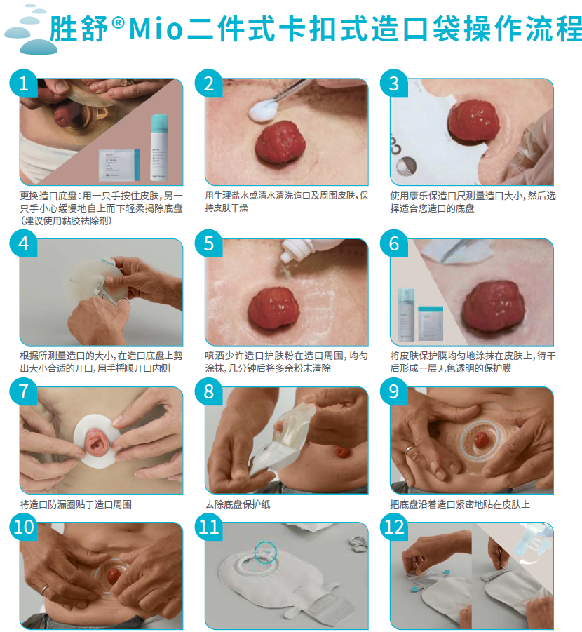 造口袋如何更换
