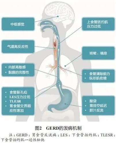 胃食管反流病患者的中医古方治疗-京东健康