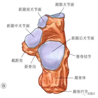 跟骨解剖:跟骨骨折概述一跟骨骨折的治疗方法很多,对于关节内骨折的