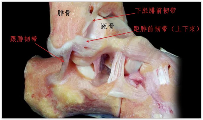 距腓后韧带解剖图片