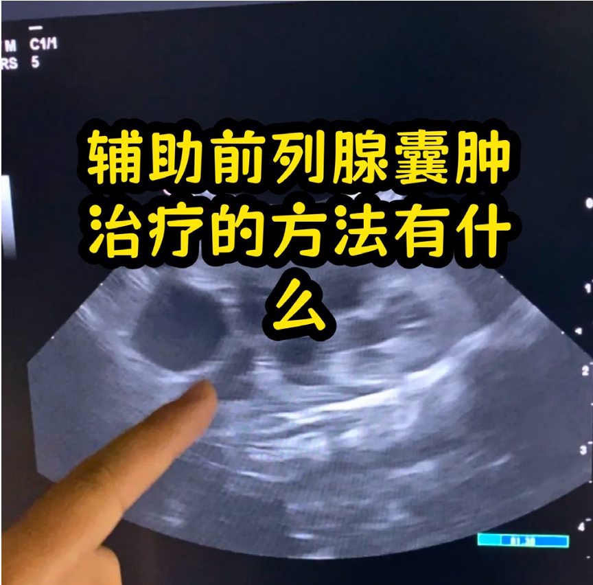 关于友谊医院全程代诊含挂号复杂病情综合分析，治疗方向更明确的信息