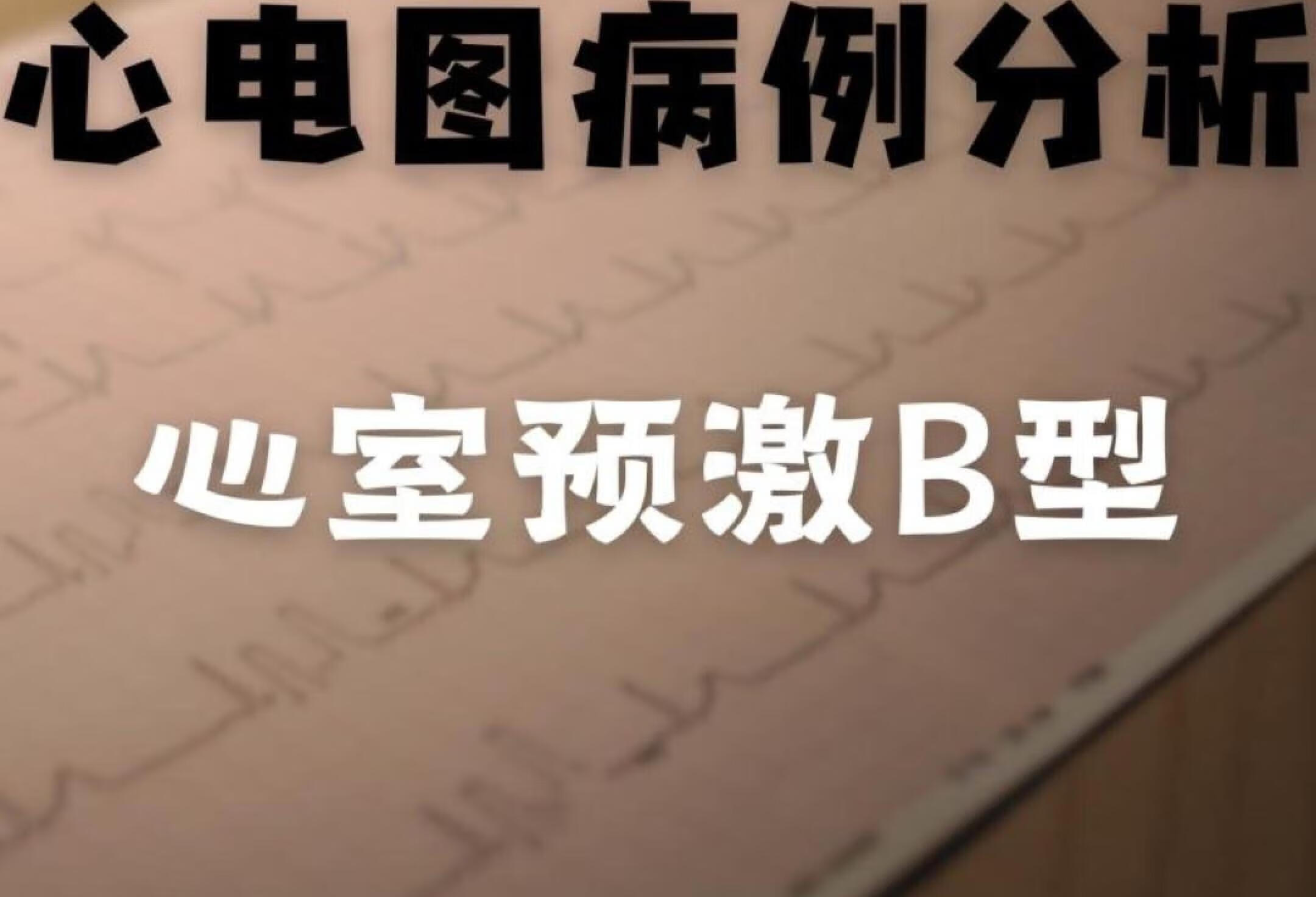 📝心电图病例分析--心室预激B型